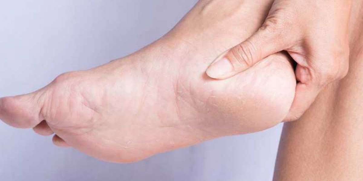 Know the Most Common Reasons of Cracked Heels