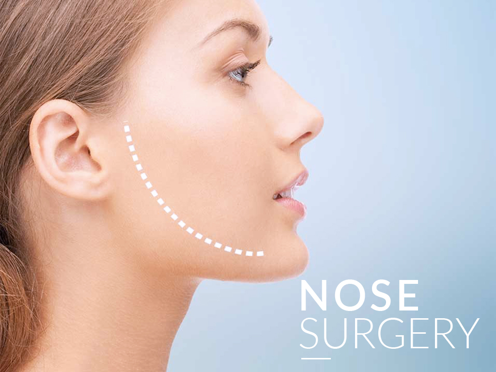 What is the Procedure of Rhinoplasty?