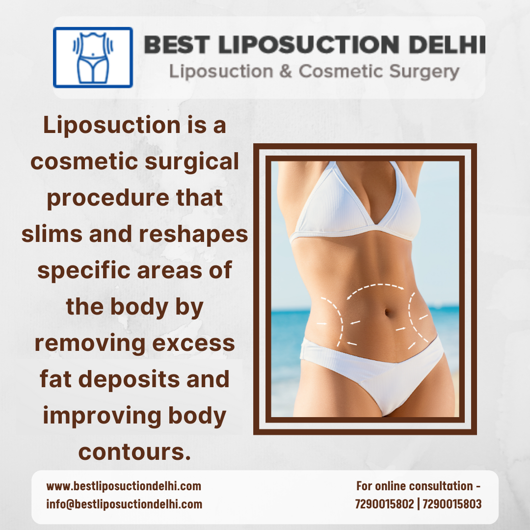 How is Liposuction Cosmetic Procedure Perfect for Thighs, Hips, and Buttocks? | by Kriti Sharma | Nov, 2021 | Medium