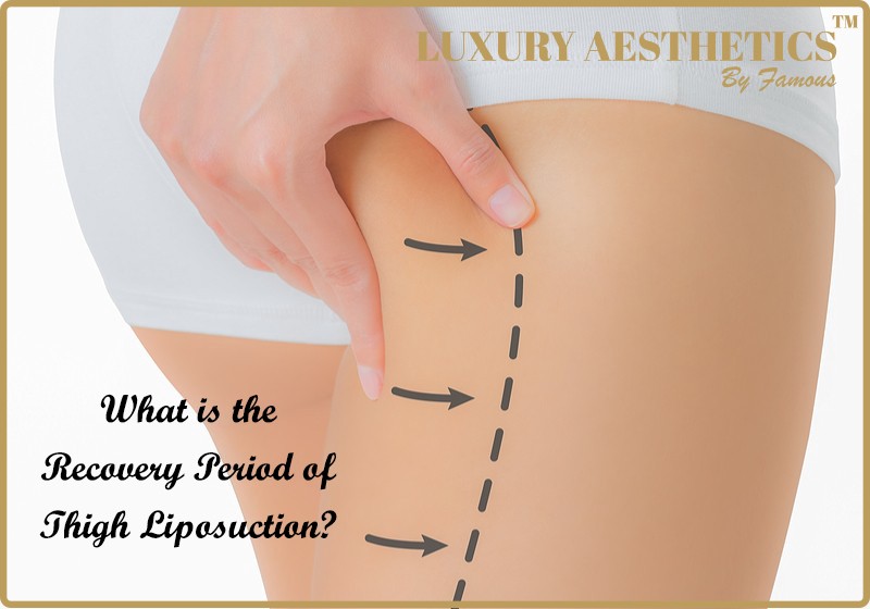 What is the Recovery Period of Thigh Liposuction?