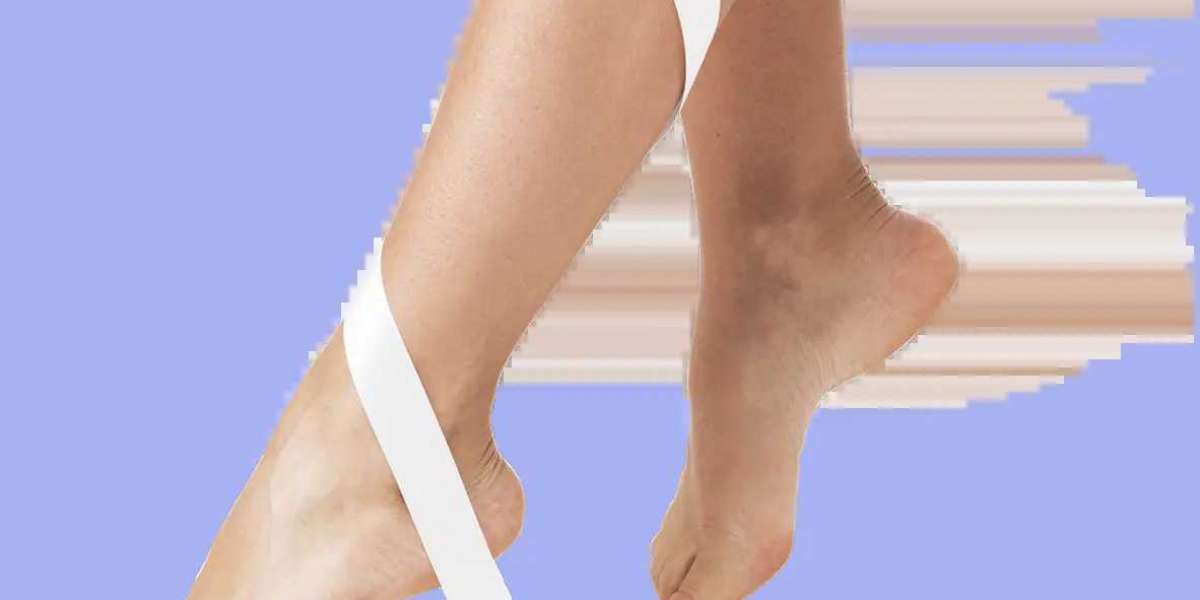 What Are The Most Effective Treatment Options For Varicose Veins?