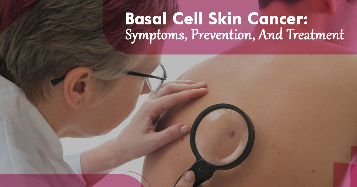 Basal Cell Skin Cancer Symptoms prevention and Treatment