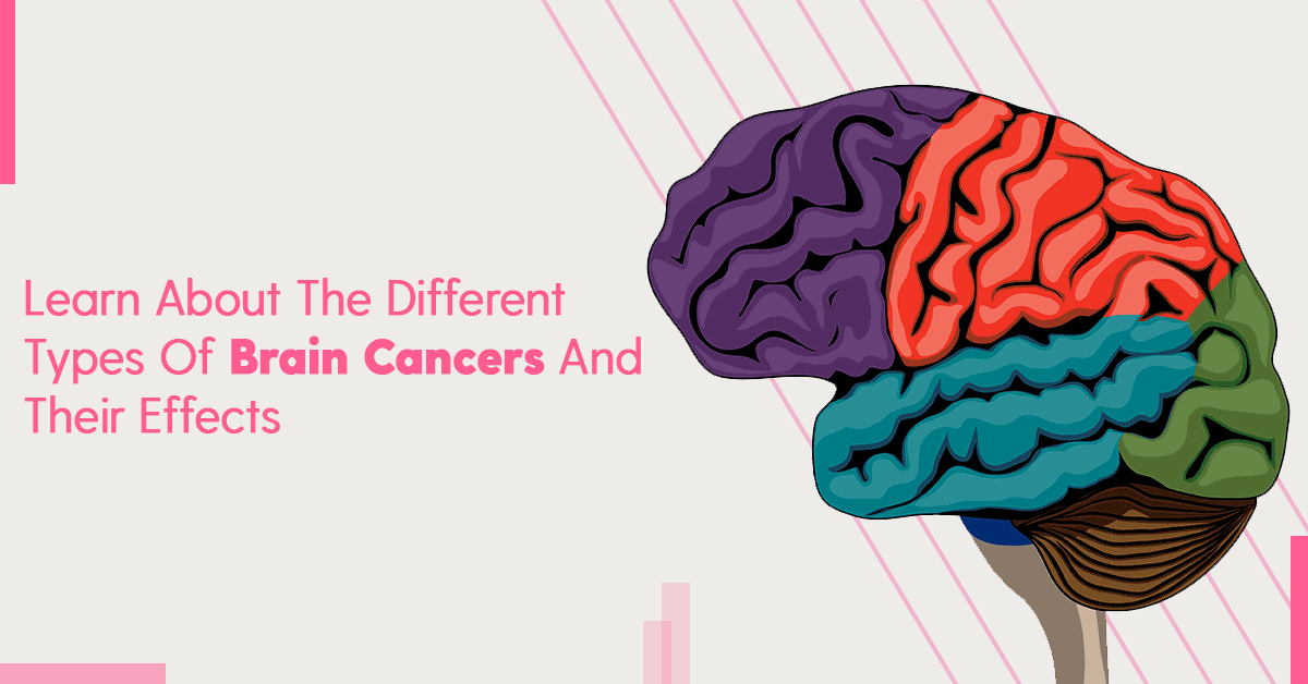 Different Types Of Brain Cancers, Effects & Treatments