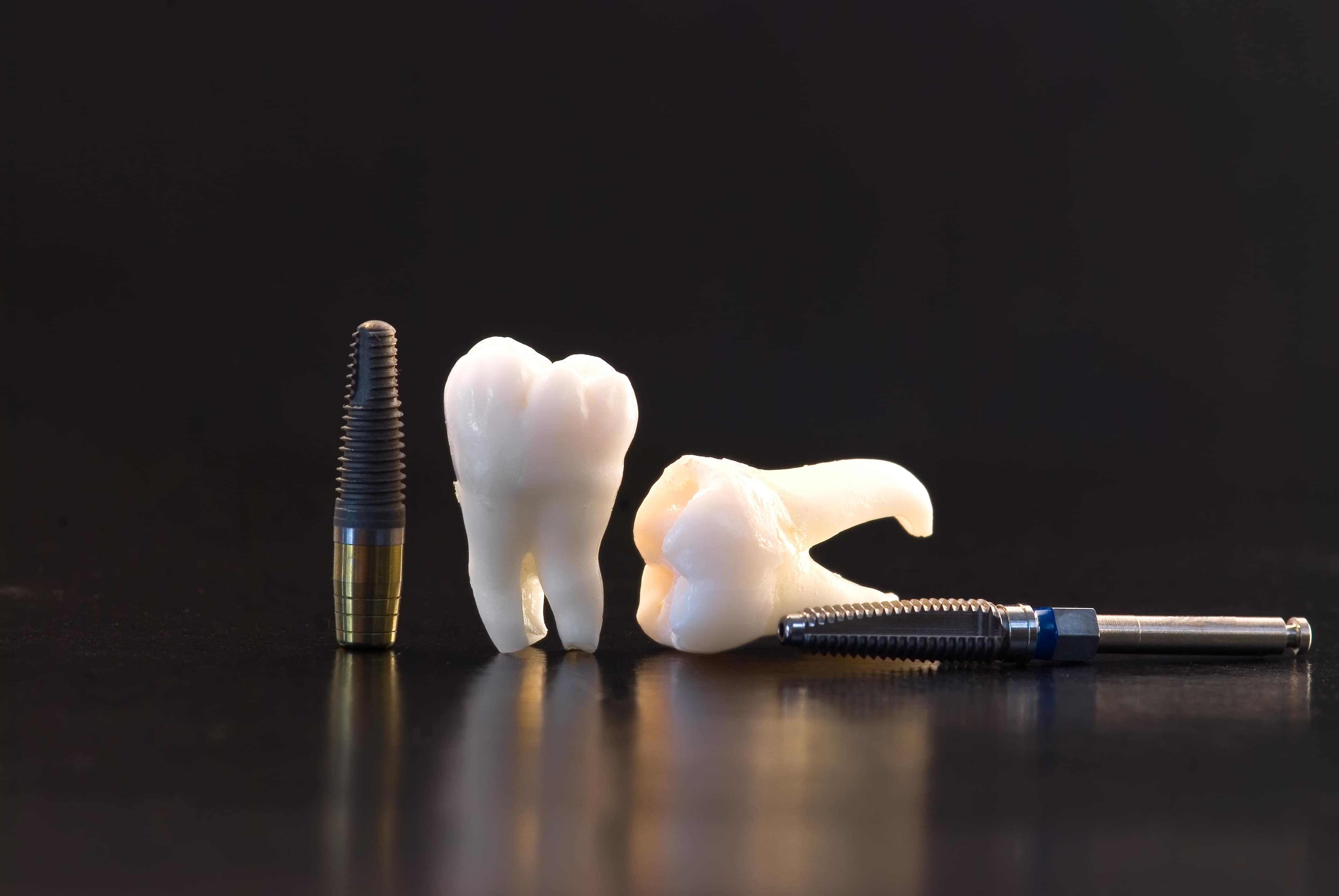 Average Cost of dental implants | East Valley Dental Professionals