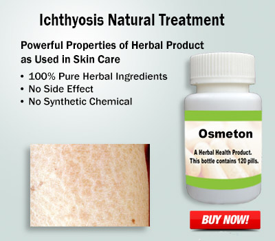 Herbal Supplement for Ichthyosis: A Natural Treatment for a Common Skin Condition