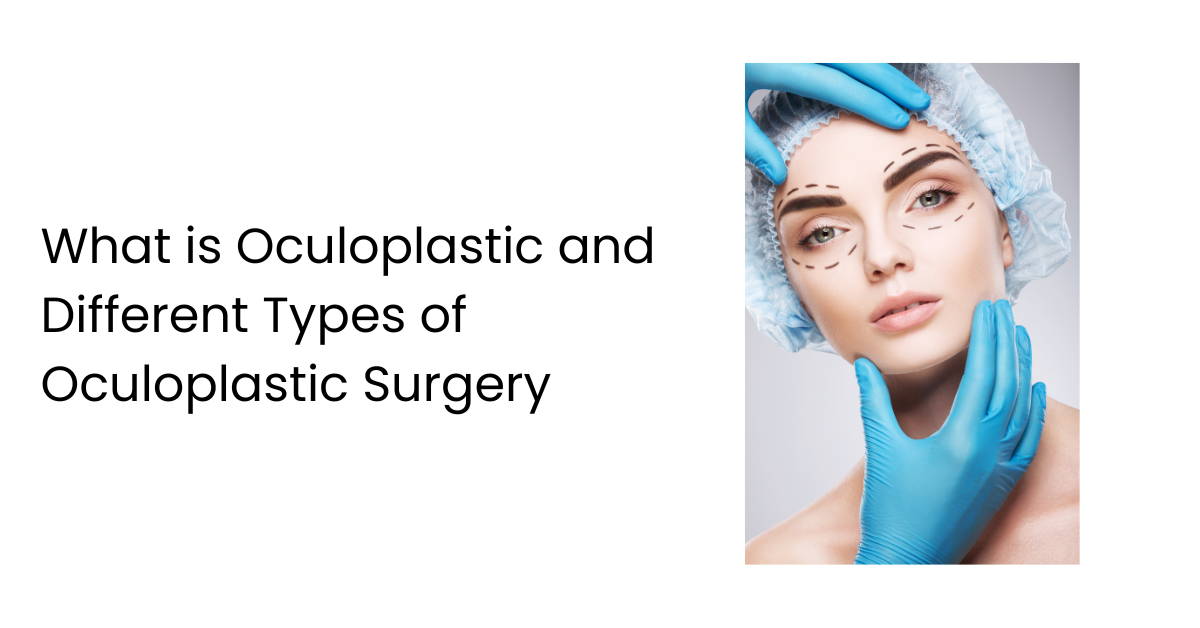 What is Oculoplastic and Different Types of Oculoplastic Surgery - AtoAllinks