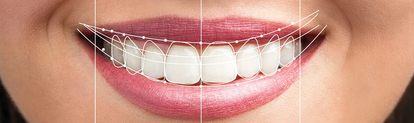 Effective Tips to Take Care of Your Smile Makeover Results -