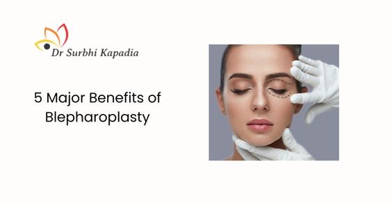 5 Major Benefits of Blepharoplasty — Dr. Surbhi Kapadia