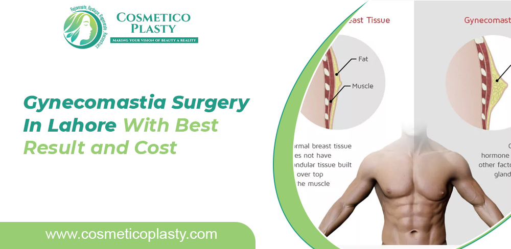Cost of Gynecomastia Surgery In Lahore to Reduce Male Breast