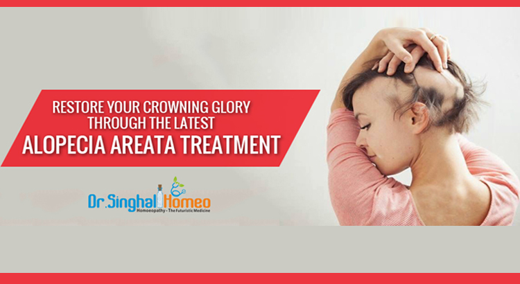Alopecia Areata Homeopathic Treatment at Affordable Prices