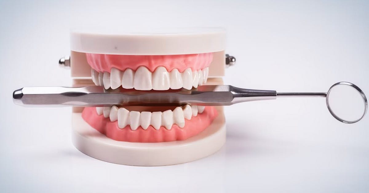 Various Dental Implants Cost Related to Tooth Replacement