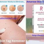 Paradise Skin Tag Remover Profile Picture