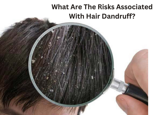 What Dandruff Risks Are Associated With It?