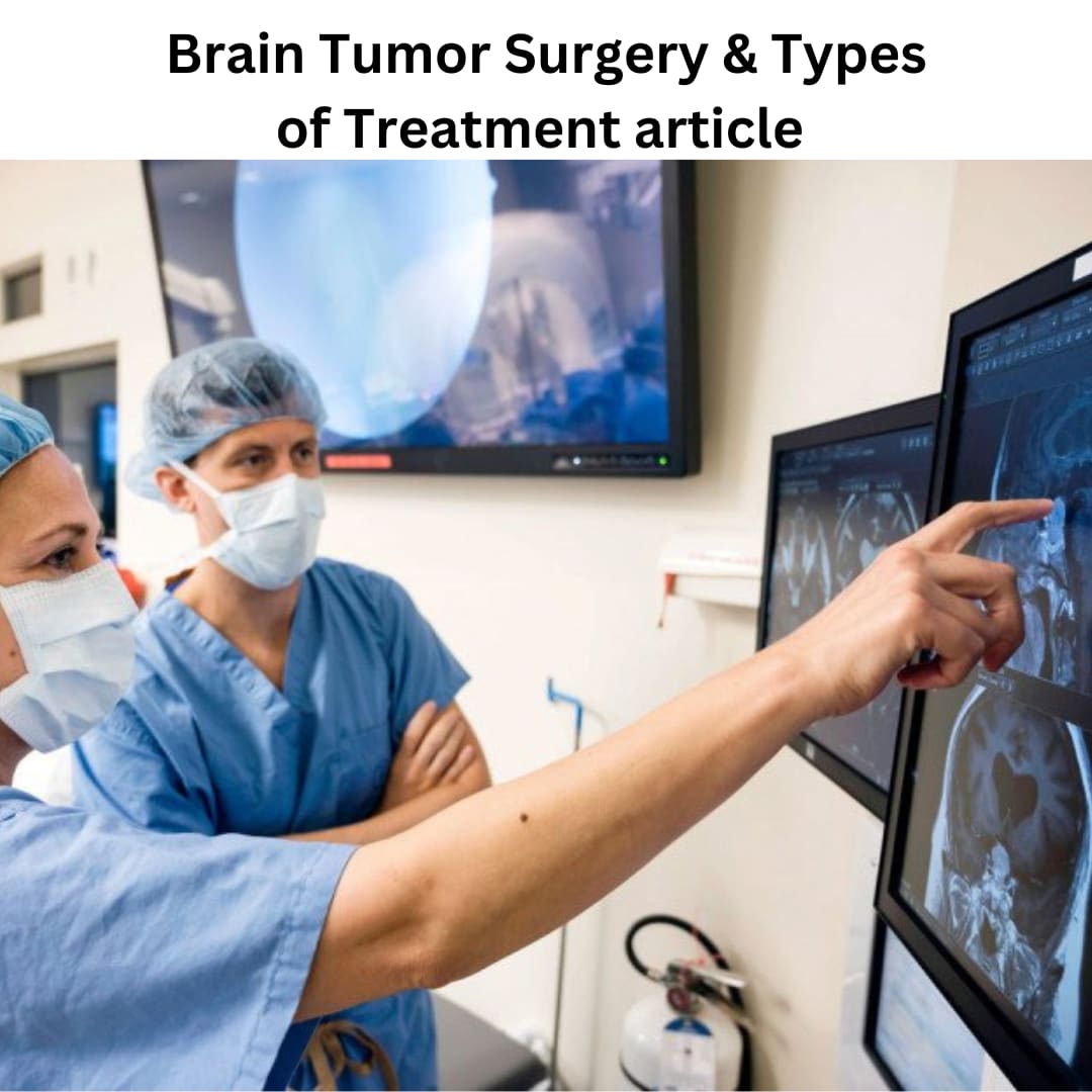 Brain Tumor Surgery & Types of Treatment article
