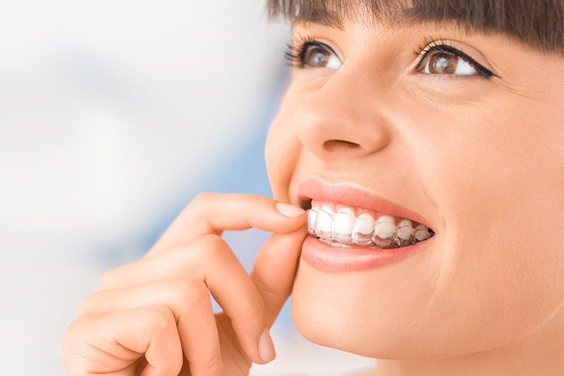 Invisible Braces, Visible Results: Discover The Magic Of Invisalign Treatment! | by Catalina Dental | Apr, 2023 | Medium