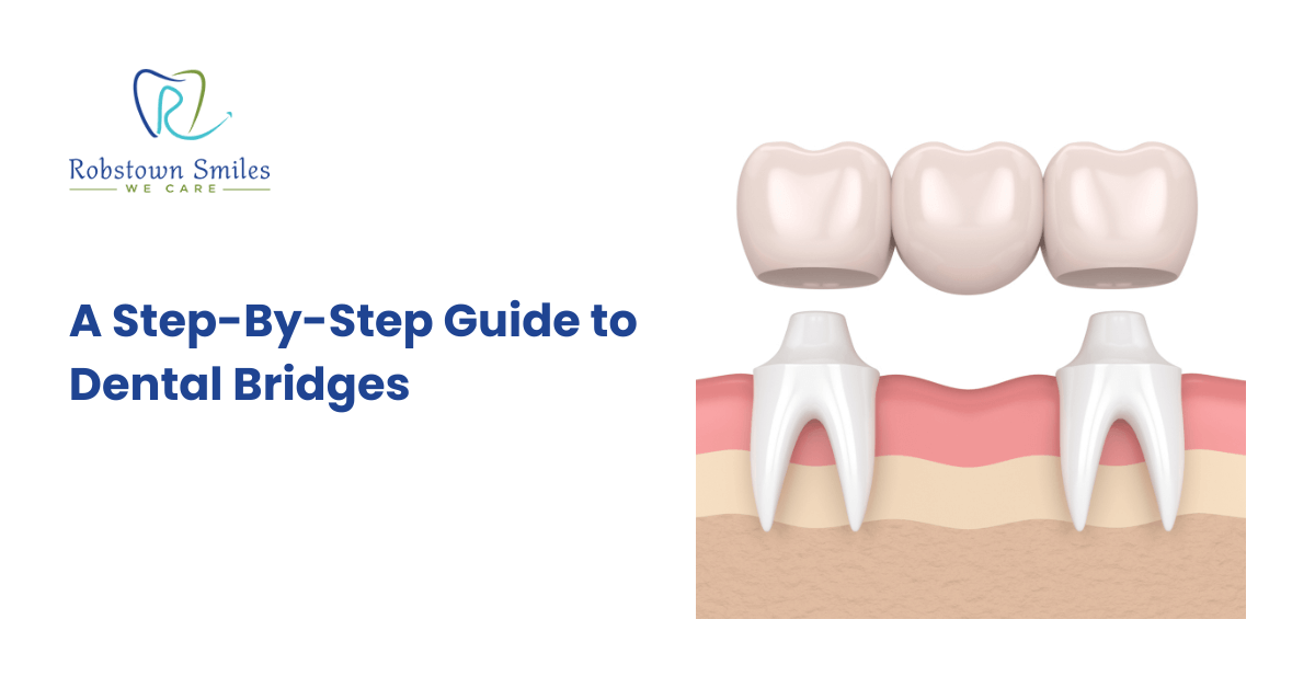 A Step-By-Step Guide to Dental Bridges - Robstown Smiles