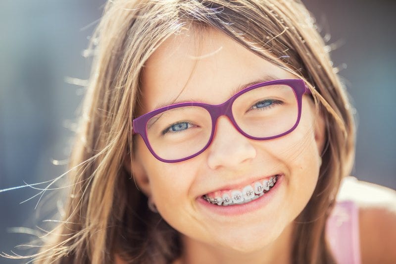 Braces Mistakes You Must Avoid. Millions of teens and adults in the… | by Opdsmiles | Apr, 2023 | Medium