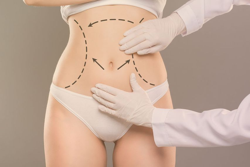 DYNAMIC AESTHETIC CLINIC IN DUBAI : Transform Your Figure: Unveiling the Secrets of Tummy Tuck in Dubai!