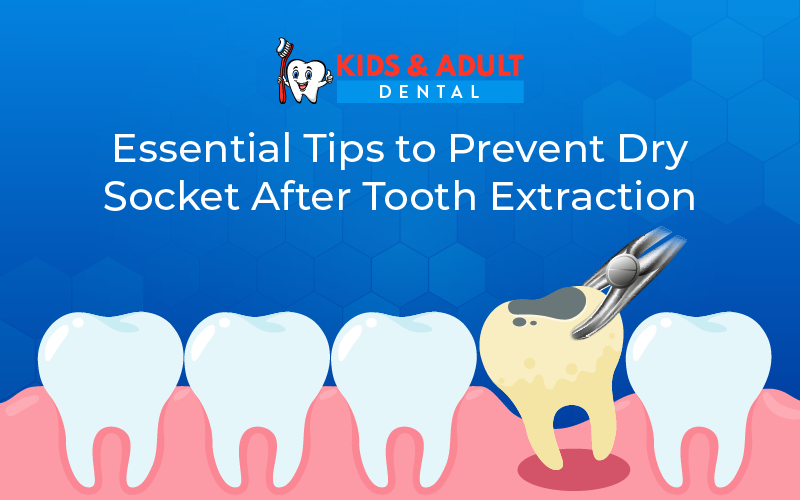 The Ultimate Guide: Essential Tips to Prevent Dry Socket After Tooth Extraction