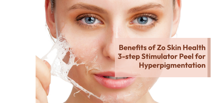 Benefits of Zo Skin Health 3-step Stimulator Peel for Hyperpigmentation