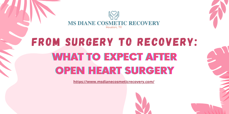 From Surgery to Recovery: What to Expect After Open Heart Surgery - Bestblog-world.com