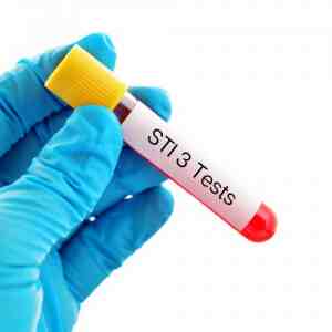 STI Test, STD Testing at Home - 3 in 1 kit Profile - £35