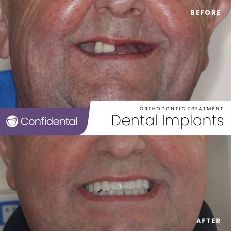 Dentist Sandhurst | Best & Private Cosmetic Dentist at Confidental Smiles