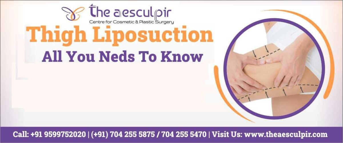 Best Liposuction / Fat Removal Surgery in Delhi | Lowest Cost