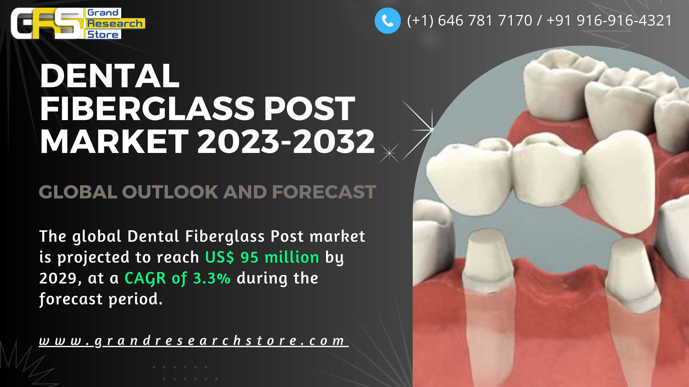 Dental Fiberglass Post Market, Global Outlook and ..
