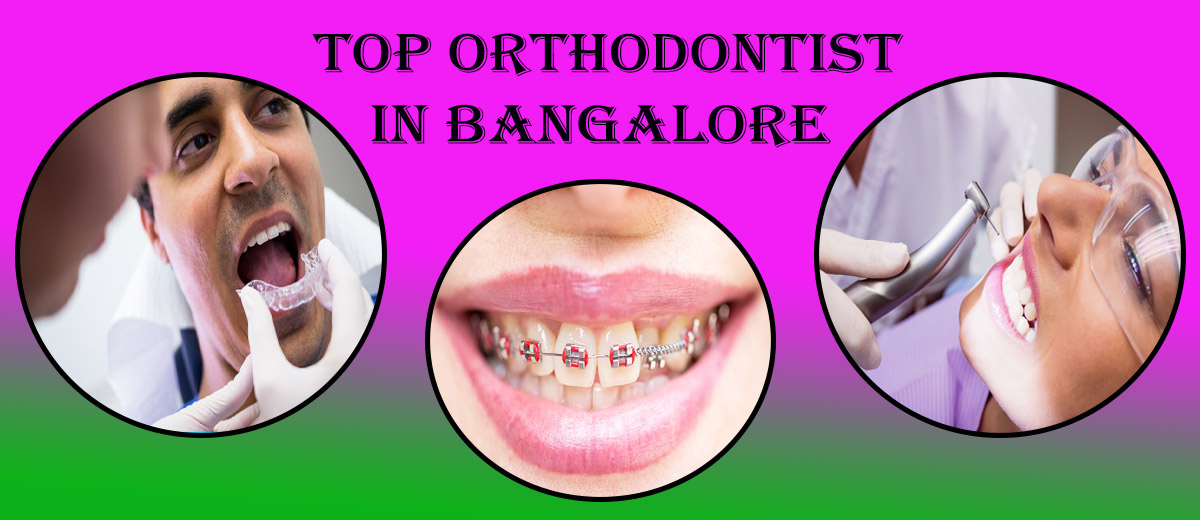 Best Orthodontist in Bangalore | Orthodontist in Bangalore