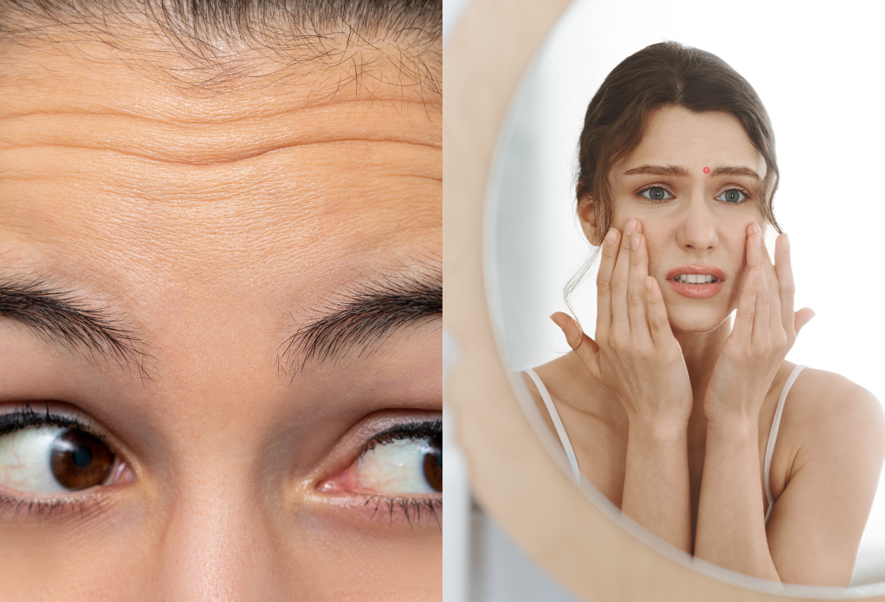 Acne Between Eyebrows: What Causes It and How To Fix It - Forever Acne Free