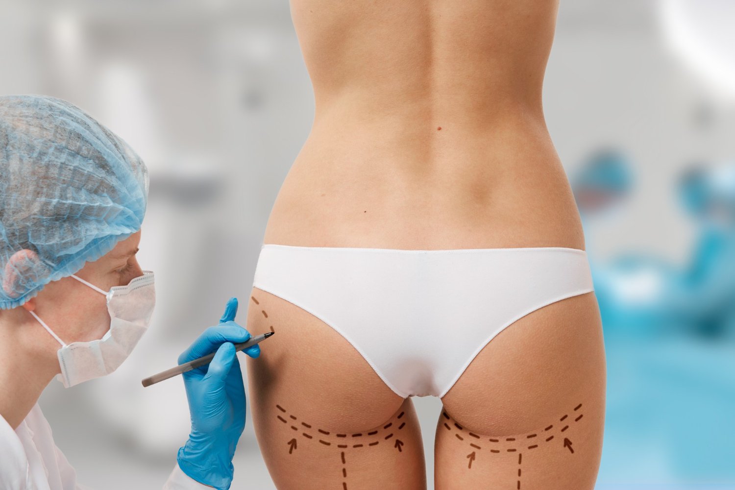 Best Gluteal Augmentation in Brazil | Rosique Plastic Surgery