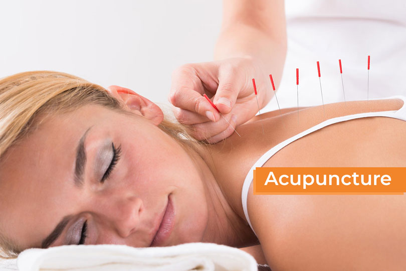 Acupuncture Clinic in Brookswood, Langley, BC - Belmont Physiotherapy