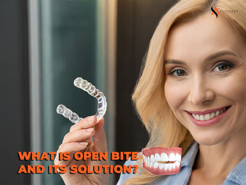 What is Open Bite? Its Causes and Treatment Options.