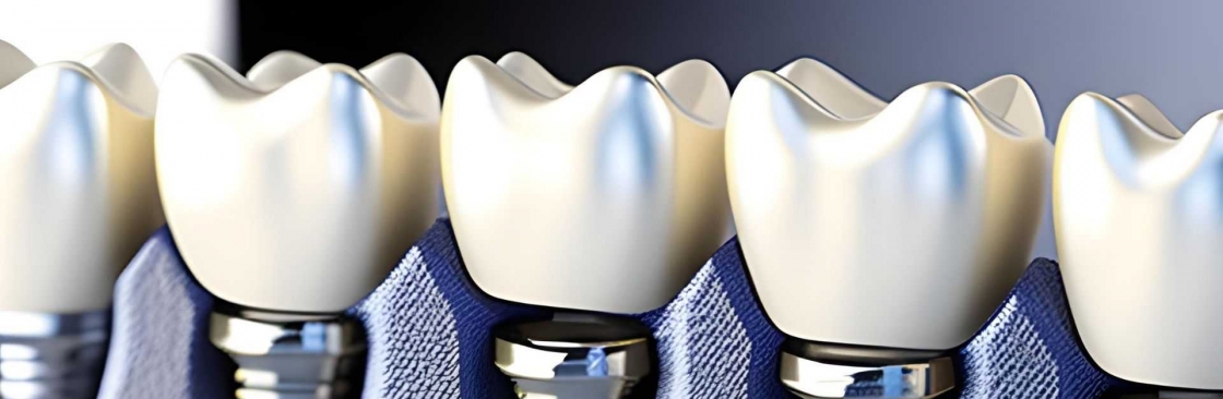 The Implant Dentists Cover Image