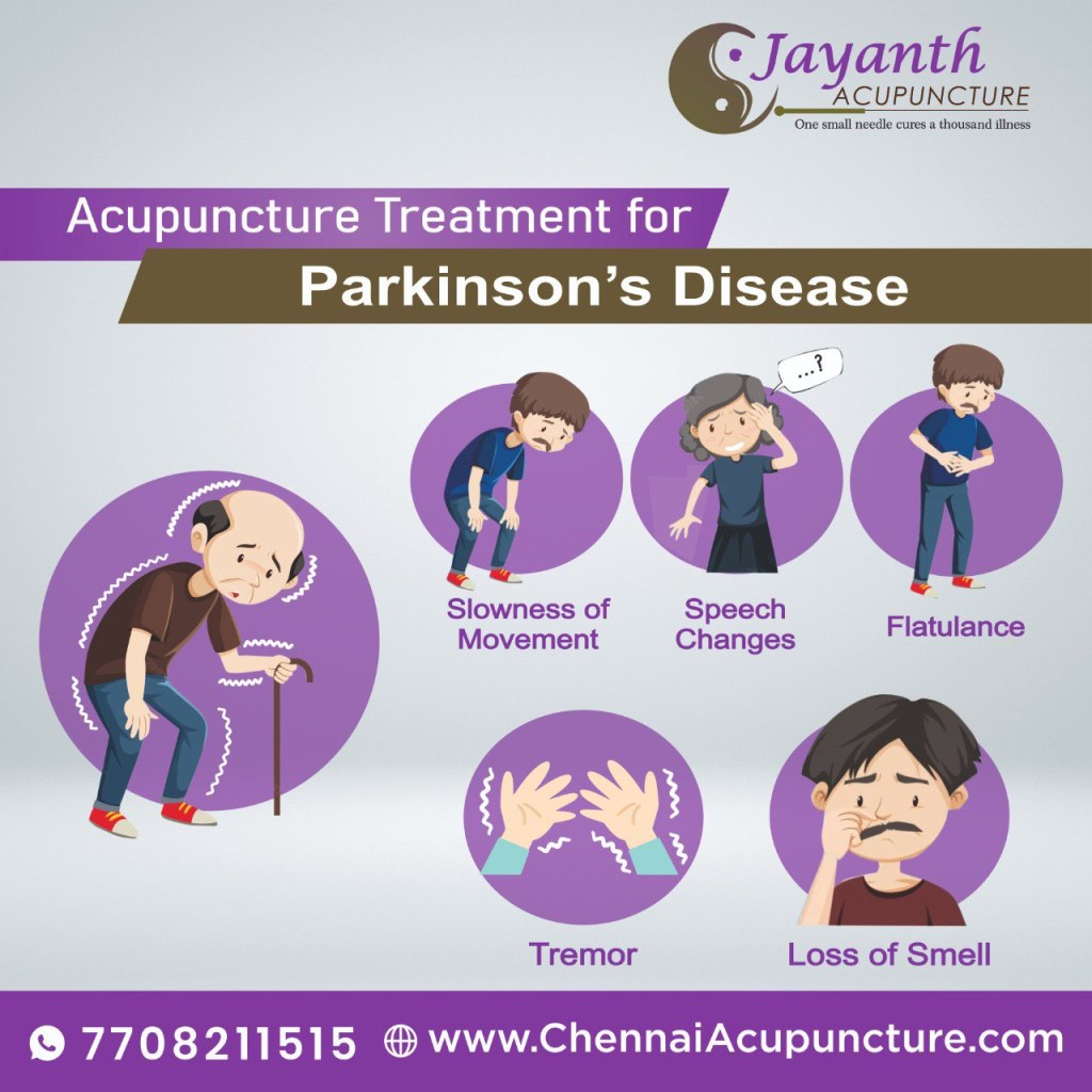 Acupuncture Treatment For Parkinson's Disease in ChennaiBest Acupuncture Treatment by Well Experienced Acupuncture Doctor in Chennai