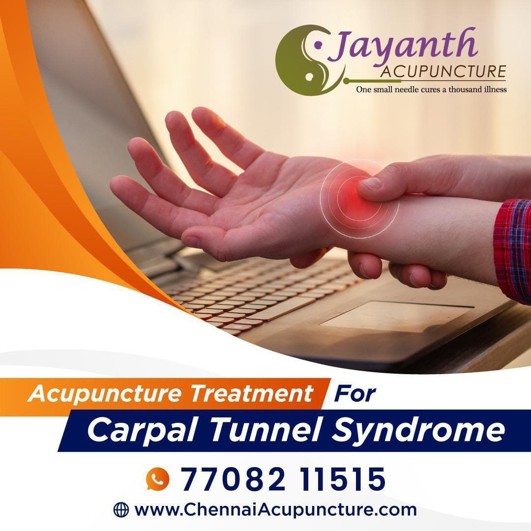 Acupuncture Treatment For Carpal Tunnel Syndrome in Chennai  - Wrist Pain Treatment