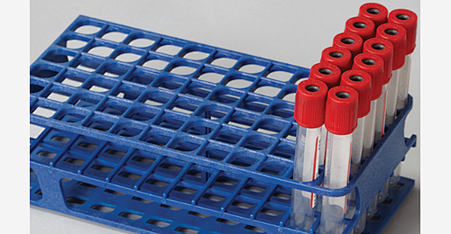 What Is The Difference Between Test Tube Rack And Holder? -  Cangzhou Yongkang Medical Devices Co., Ltd