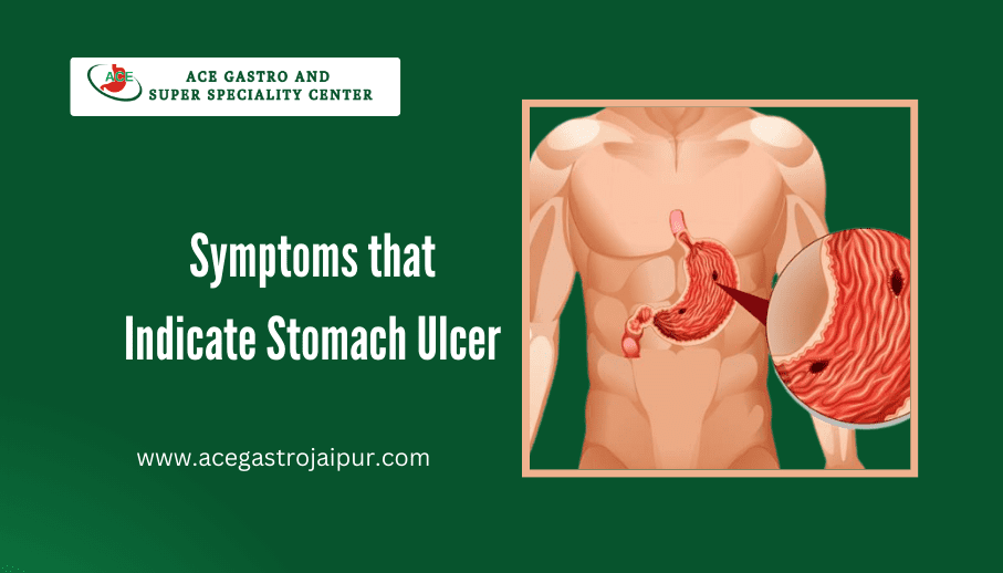 Symptoms that Indicate Stomach Ulcer - ACE Gastro Jaipur
