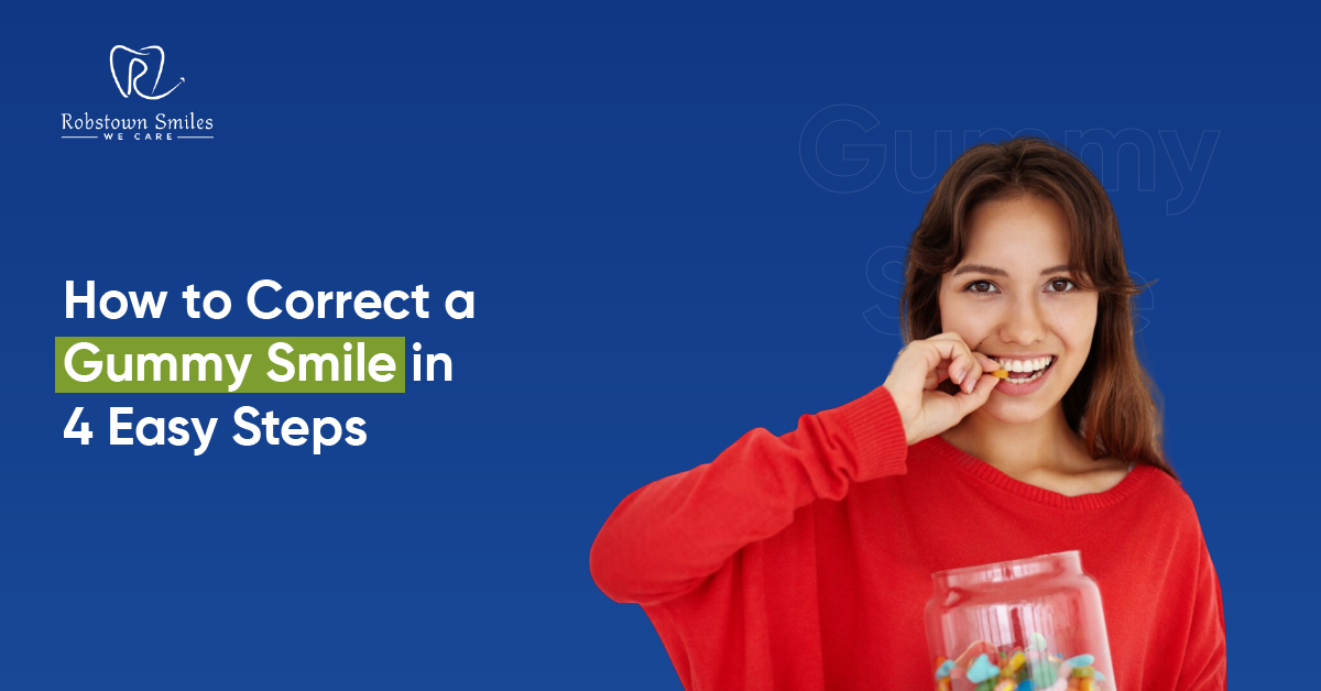 How to Correct a Gummy Smile in 4 Easy Steps | Robstown Smiles