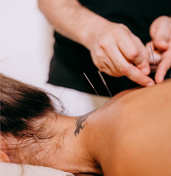 Elevating Care: Unveiling the Distinctive Practices of Dry Needling Physiotherapy in Surrey and the Best Acupuncture in Surrey, BC - XuzPost