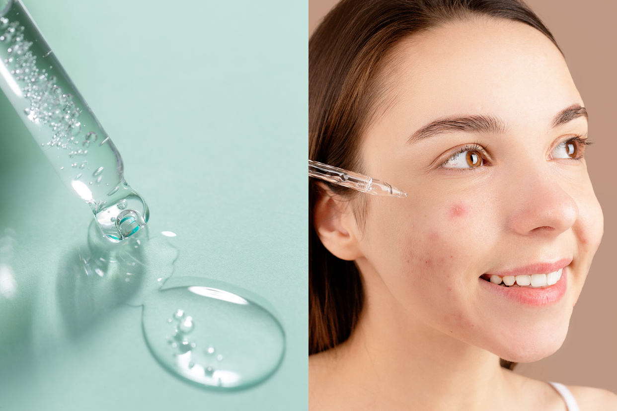 The 10 Best Serums for Acne-Prone Skin - Forever Acne Free