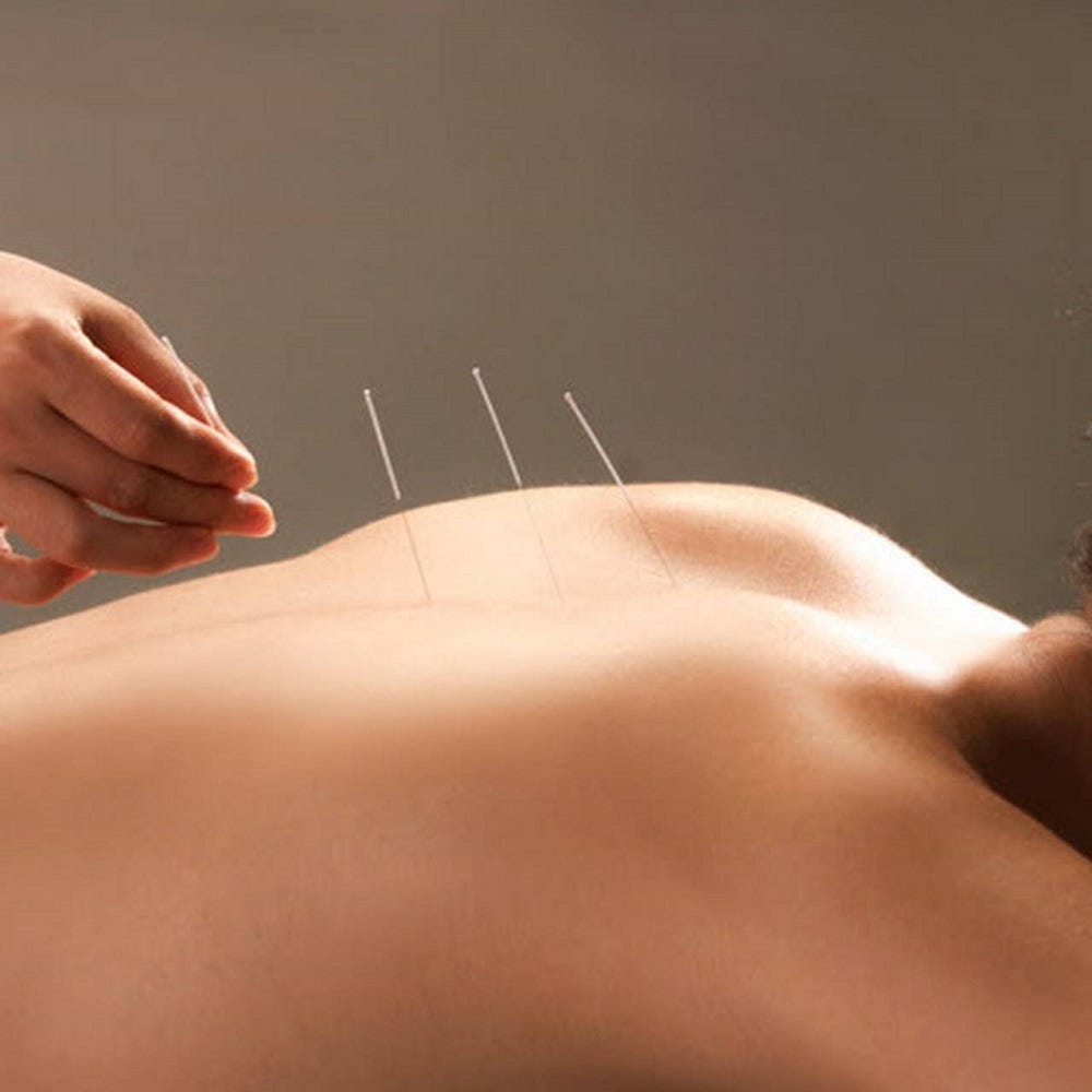 Beyond Needles: Unlocking the Power of Acupuncture in Pain Relief | by North Shore Acupuncture | Mar, 2024 | Medium