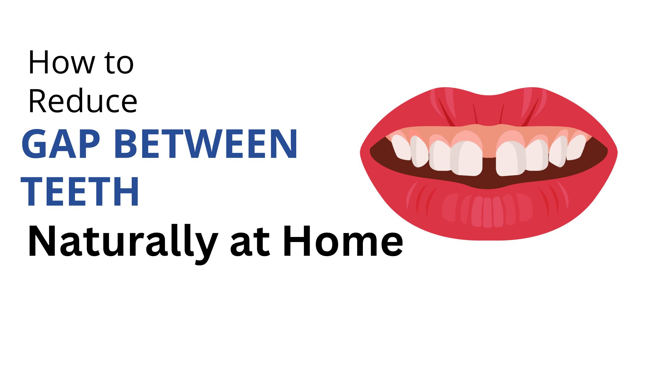 How to Reduce Gap Between Teeth Naturally at Home?