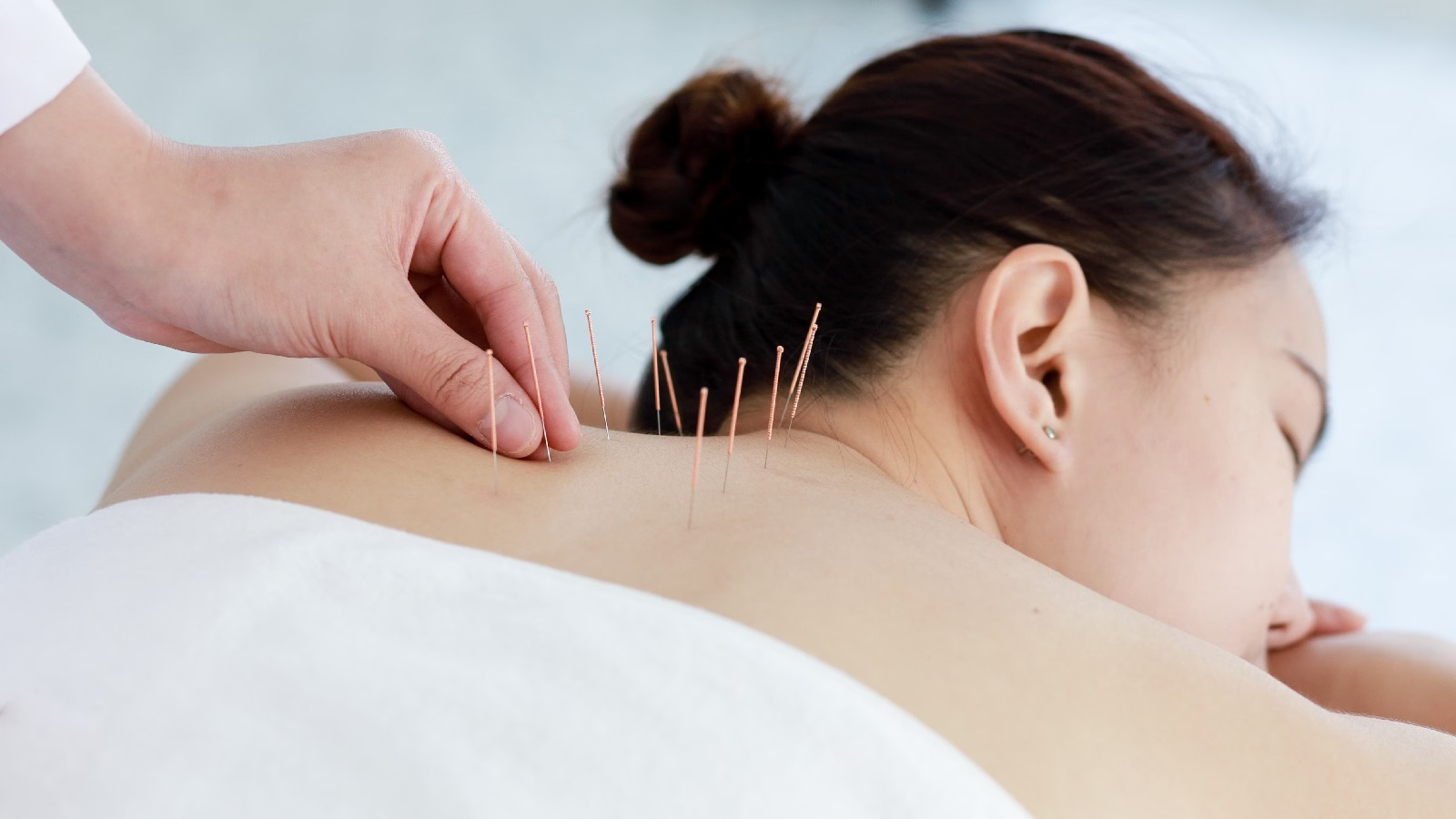 Discover Acupuncture In Ridgefield CT: Boost Health In Ridgefield, CT - Newsideas.in Discover Acupuncture In Ridgefield CT: Boost Health In Ridgefield, CT