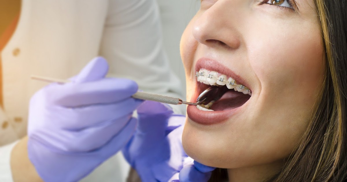 Achieving a Perfect Smile with Invisalign Treatment