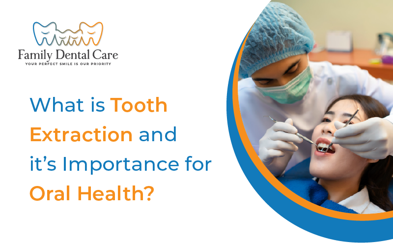 What is Tooth Extraction? And how does it Improve Oral Health?