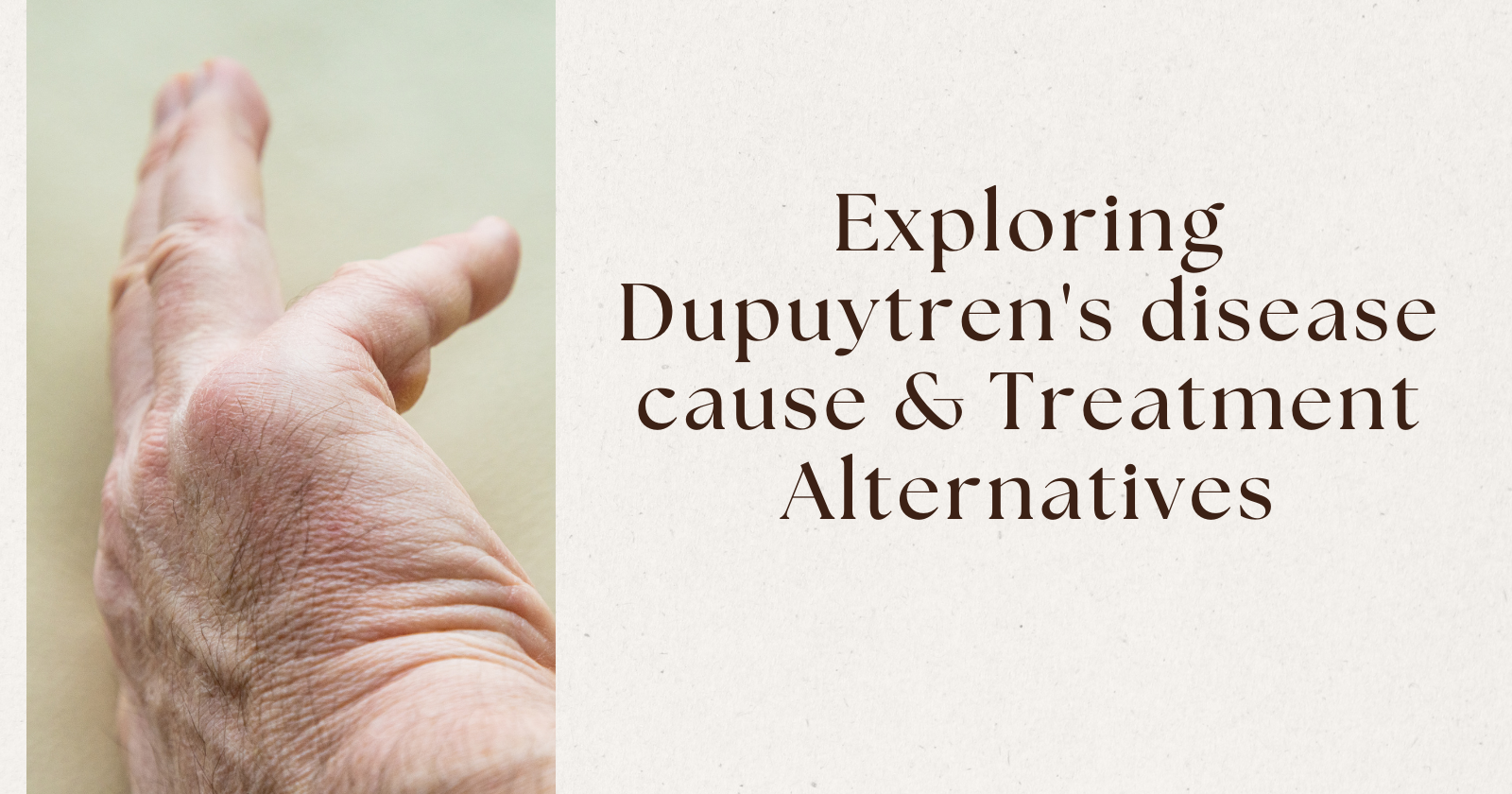Exploring Dupuytren's disease cause & Treatment Alternatives 