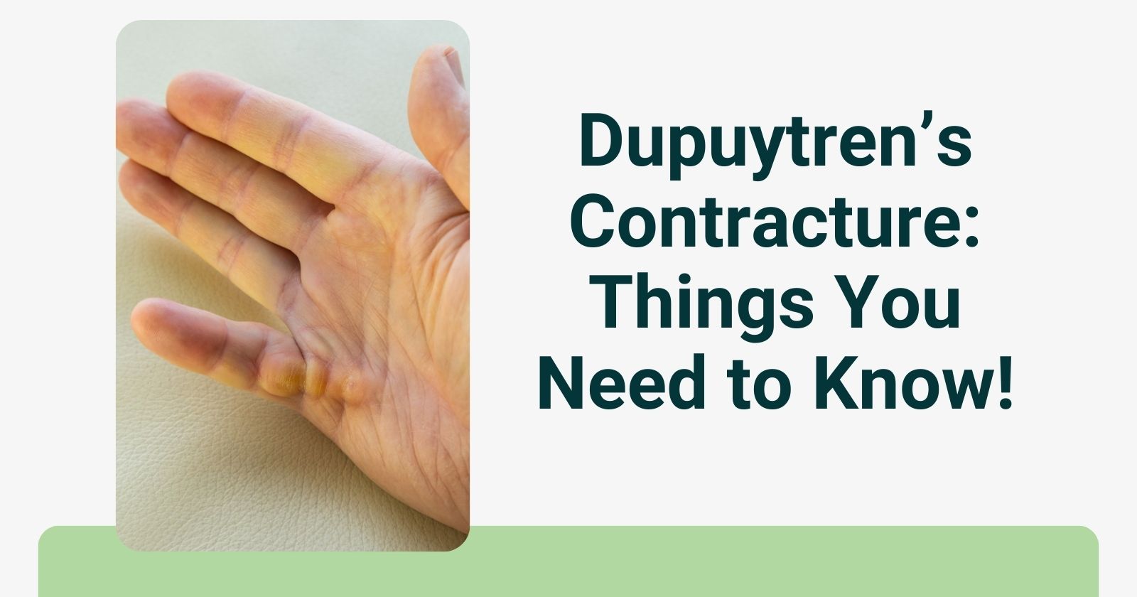 Dupuytren's Contracture: Things You Need to Know! - Dupuytrencure