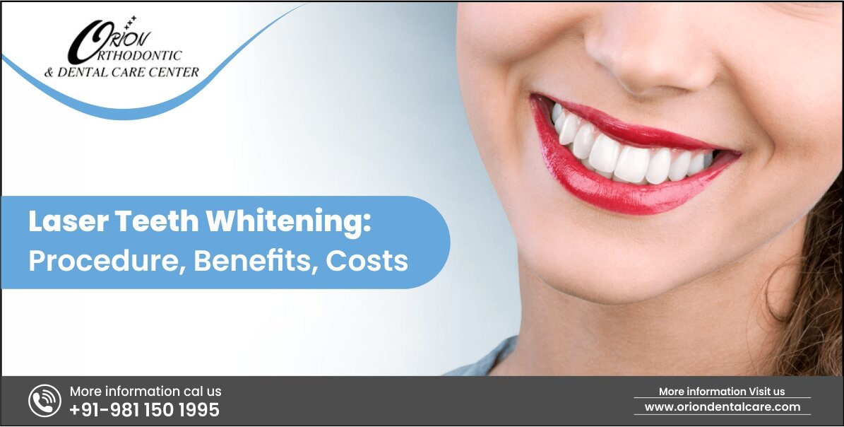 Teeth Whitening – Conventional Vs. Laser Whitening - Orion Dental Care | Blog
